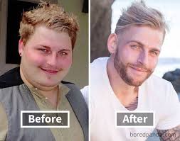 face before and after weight loss