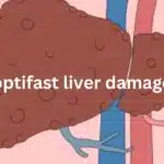 optifast liver damage