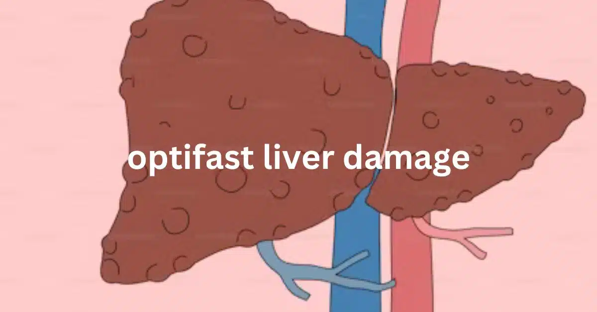 optifast liver damage